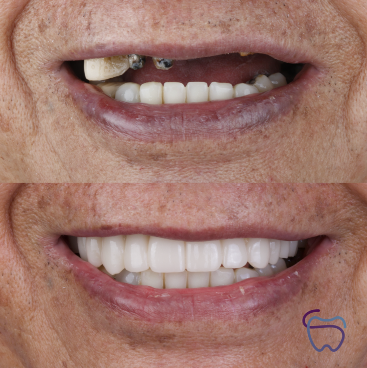 Resultado dental antes y después
